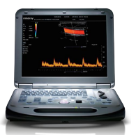 邁瑞便攜式彩色多普勒超聲系統m55